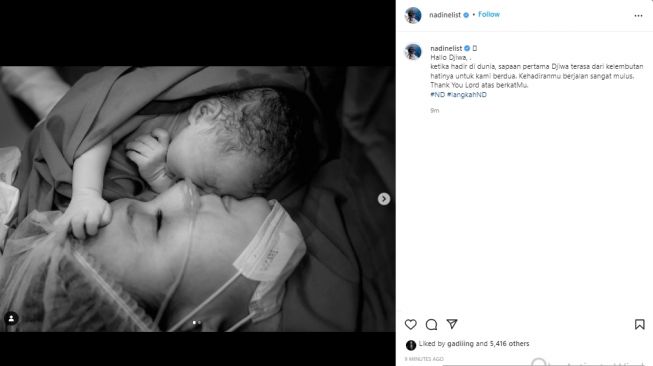 Nadine Chandrawinata dan Dimas Anggara dikaruniai anak pertama (instagram.com)