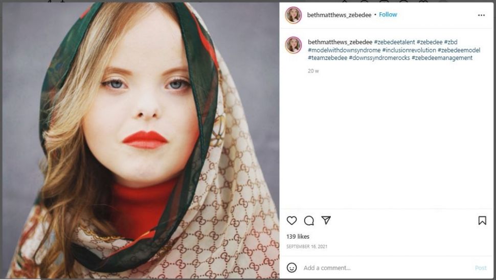 Model Down Syndrome Beth Matthews (instagram.com/bethmatthews_zebedee)