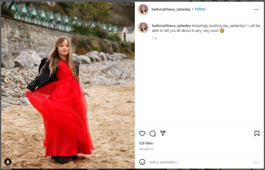 Model Down Syndrome Beth Matthews (instagram.com/bethmatthews_zebedee)