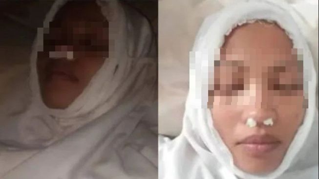 Ditagih Utang Rp 4,2 Juta, Perempuan Ini Nekat Palsukan Kematian Hingga Foto Pakai Kain Kafan. (Dok: Facebook)